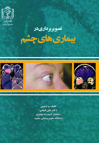 تصویربرداری در بیماری های چشم